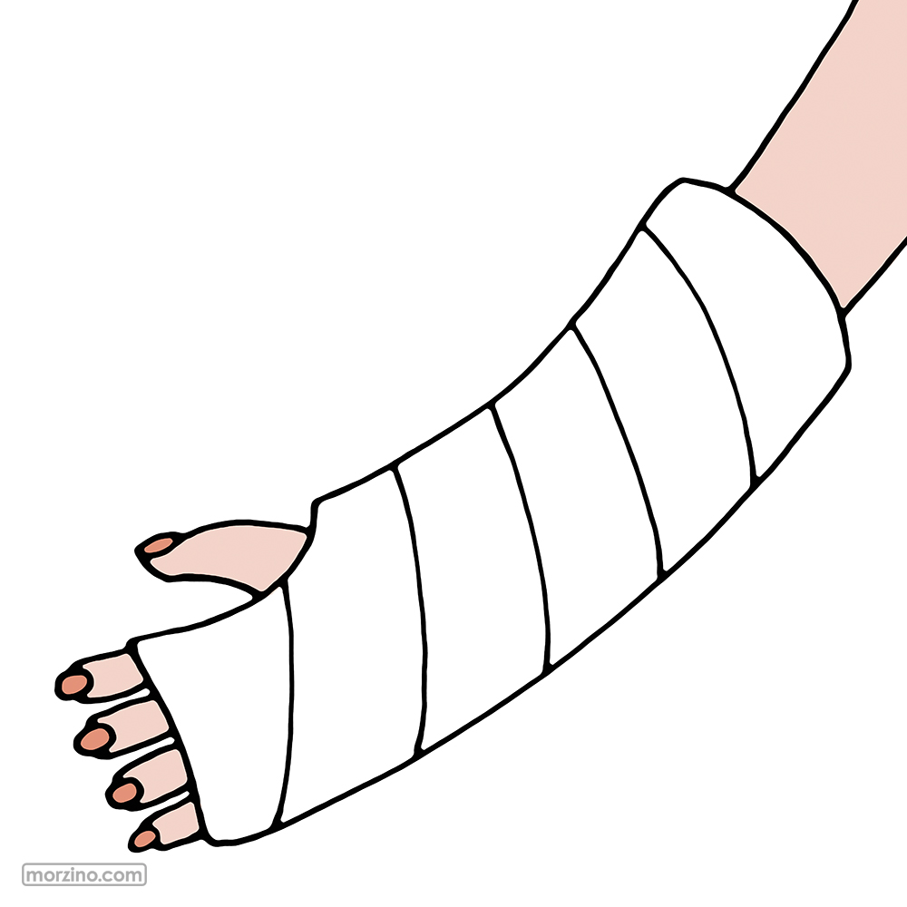 Bildwörterbuch: Gipsverband