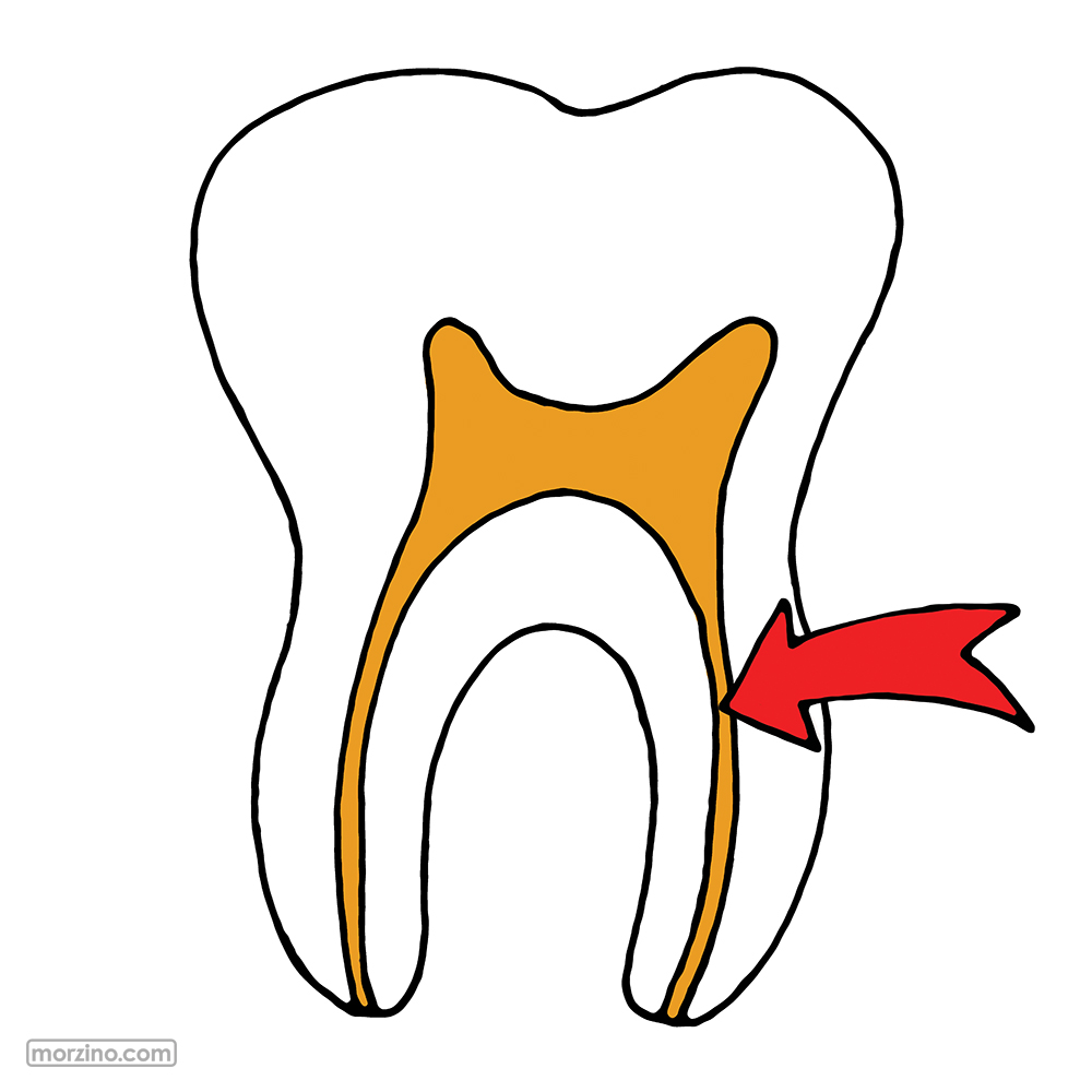 Bildwierderbuch: Nerv vum Zant