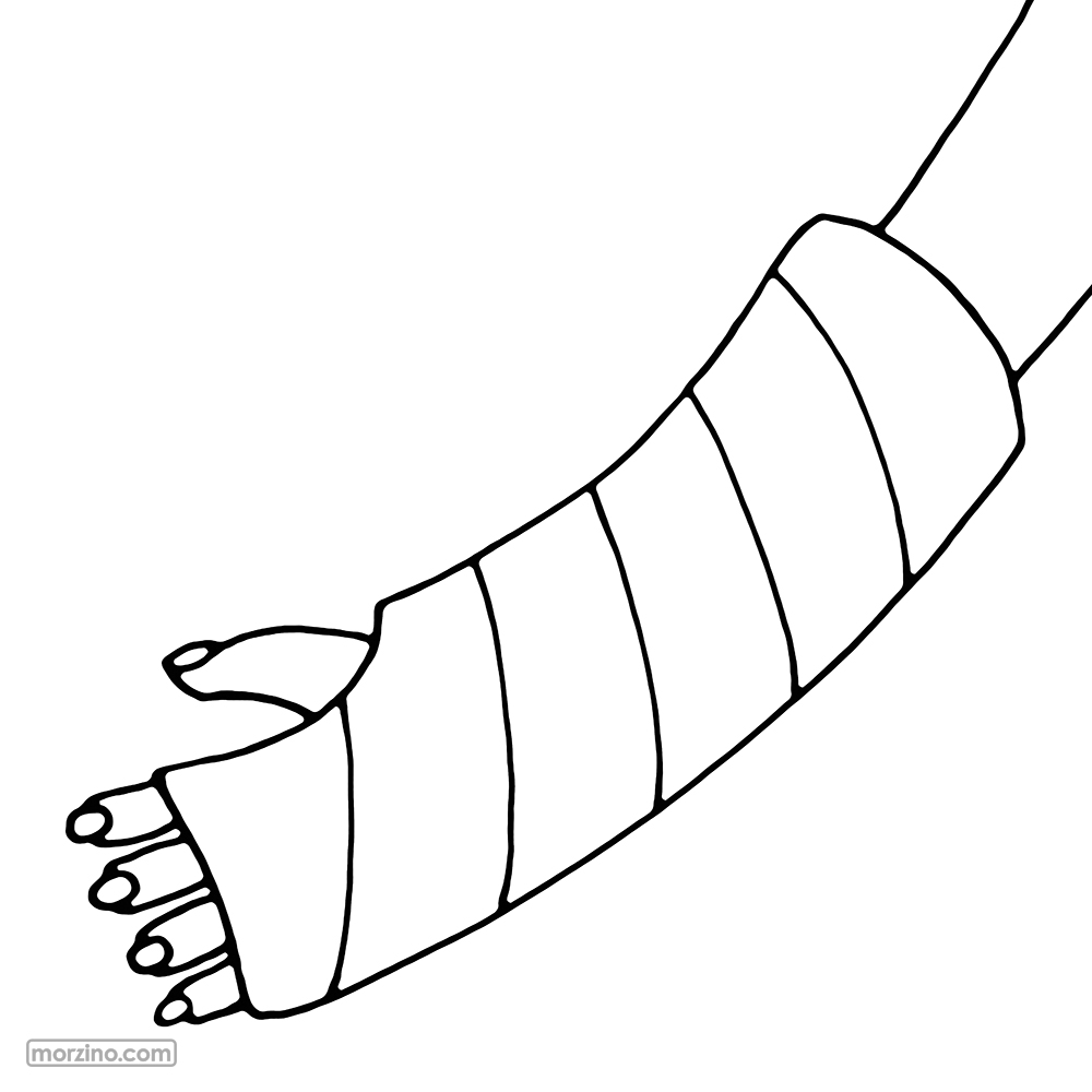 Ausmalbild: Gipsverband