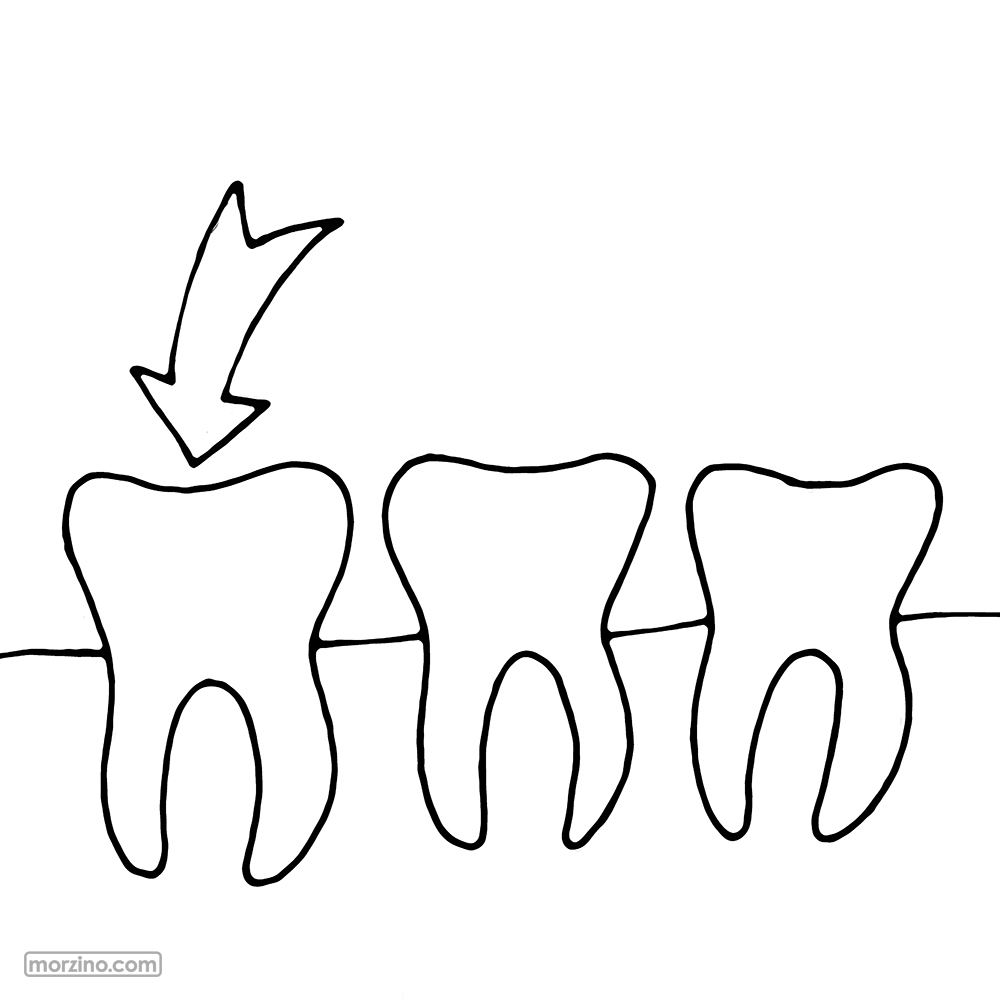 Bildwörterbuch: Zahn