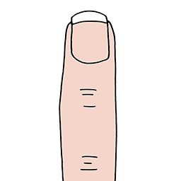 Finger